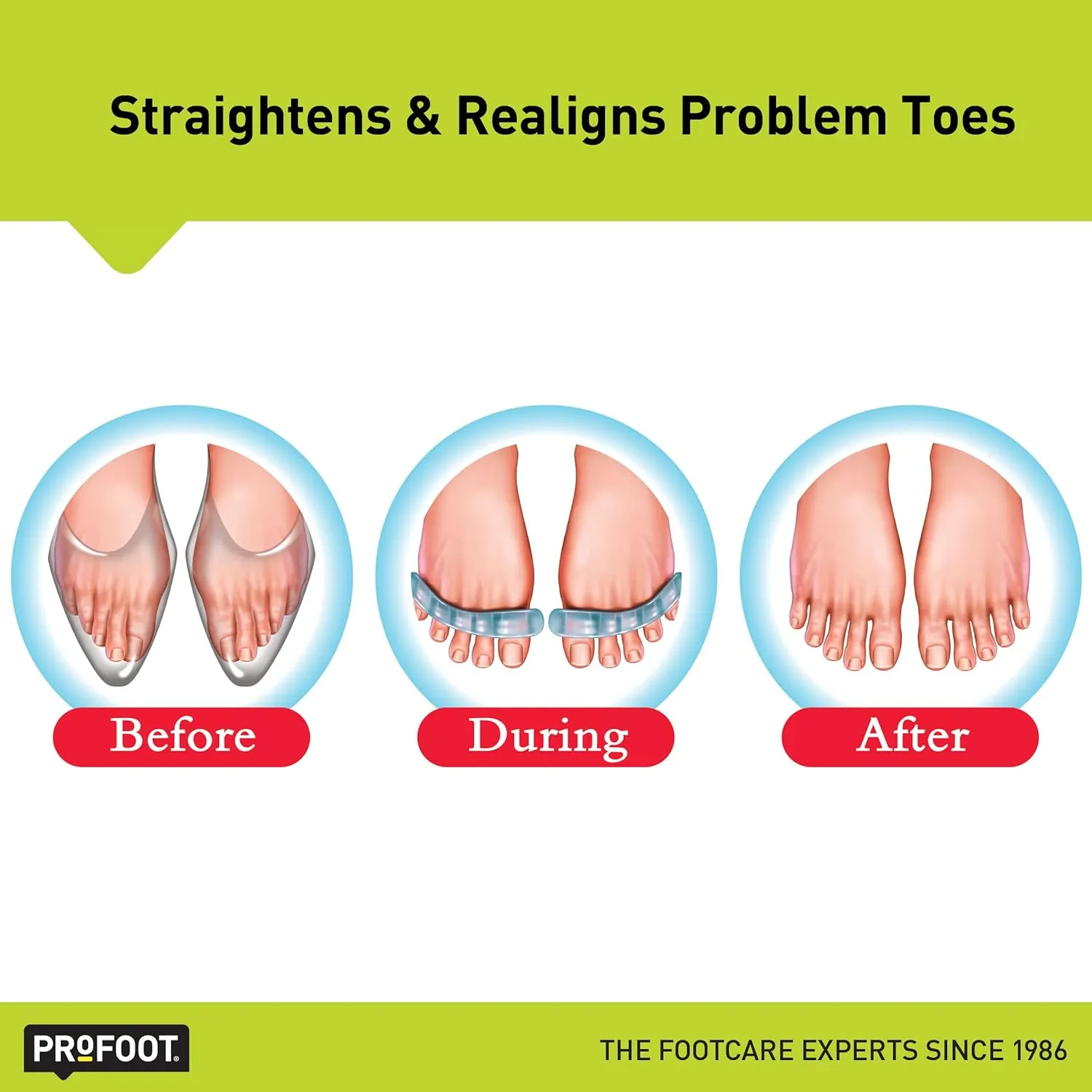 Flex-Tastic Toe Relaxers